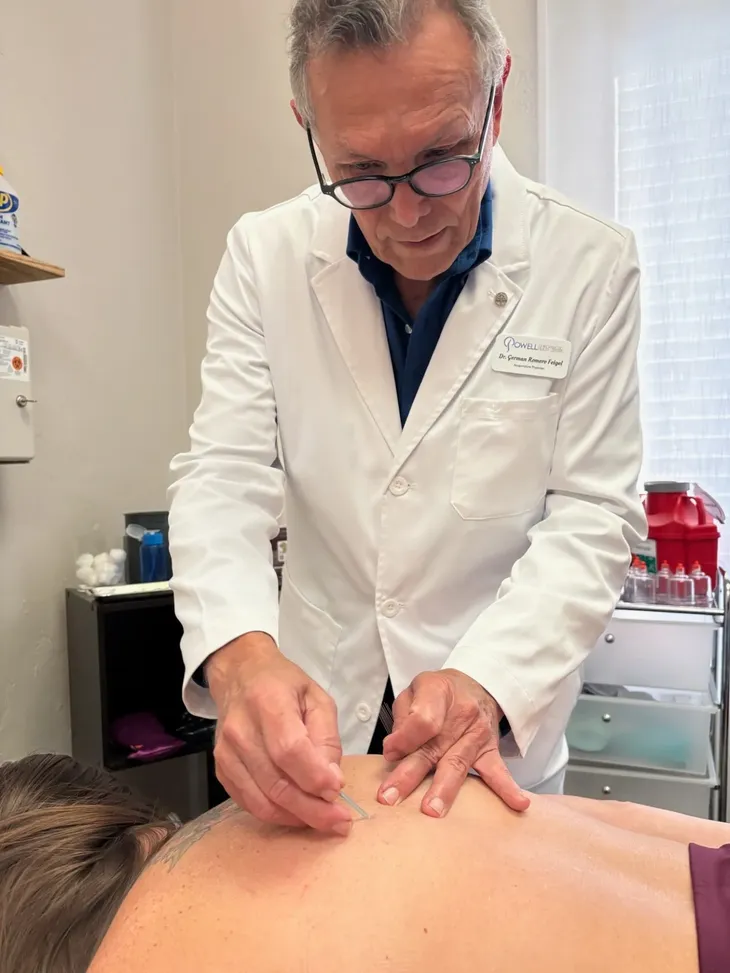 A photo of our acupuncture physician giving acupuncture to a patient